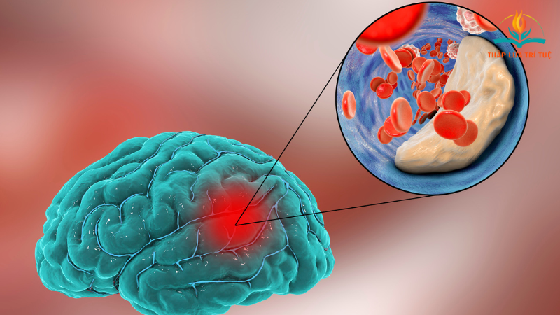 trẻ con mắc hội chứng TIC